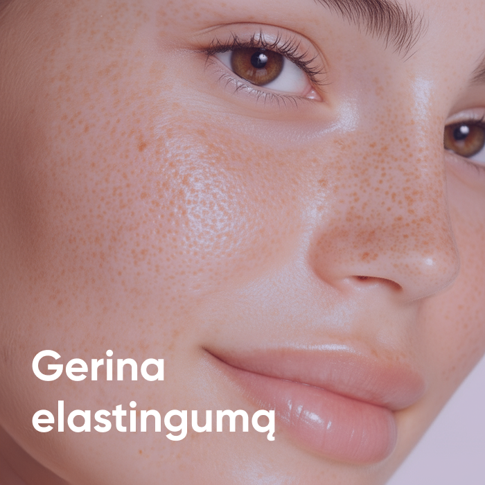Artimas vaizdas į moters veidą su strazdanomis, rodantis lygią odą – Skinifull gerina odos elastingumą.