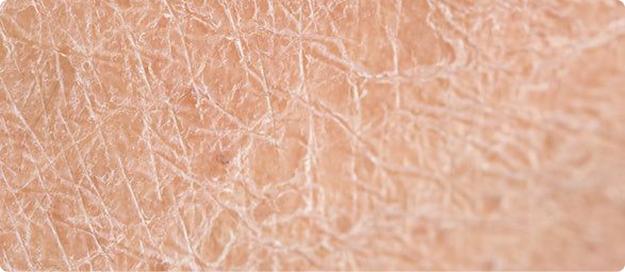 brandi dehidratuota oda